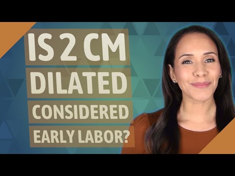 Is 2 cm dilated considered early labor?
