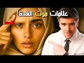 10 علامات غريبة على قصور الغدة الدرقية و أقوى علاج طبيعي