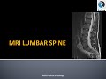 Lumbar Spine MRI Part 1: Indications, Protocols, Layout