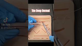 Suture BIG HOLES #suture #doctor #orthopedicsurgeon #plasticsurgeon #medicalstudent #nursepractioner