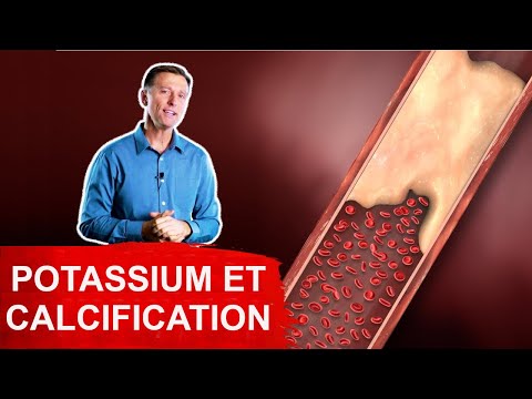 Le Potassium Pour Prévenir La Calcification Vasculaire Et L&rsquo; Hypertension. l Dr Eric Berg