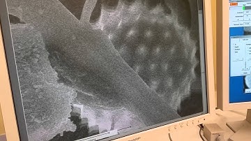 Scanning Electron Microscope Video of Charging Pollen Grain on Spider Leg