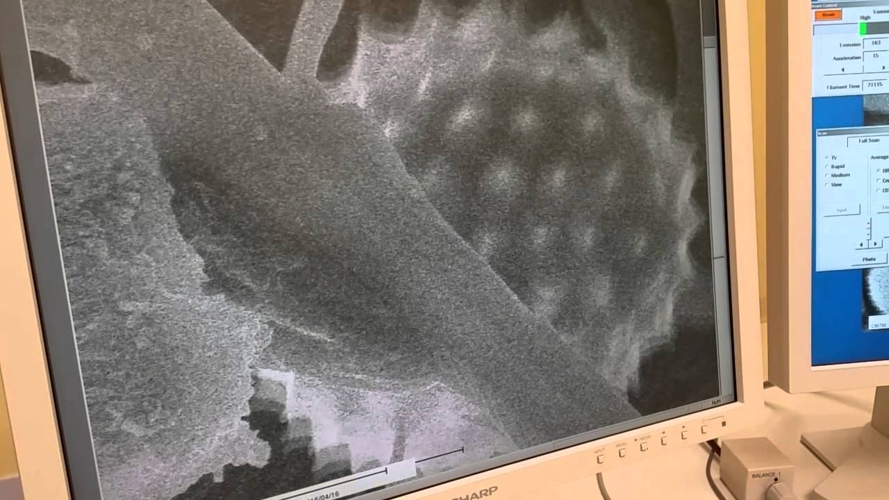 Scanning Electron Microscope Video of Charging Pollen Grain on Spider ...