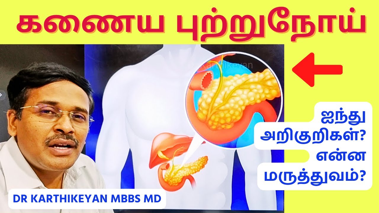 நீங்கள் கட்டாயம் தெரிந்து கொள்ள வேண்டிய கணைய புற்றுநோயின் அறிகுறிகள் | pancreatic cancer signs