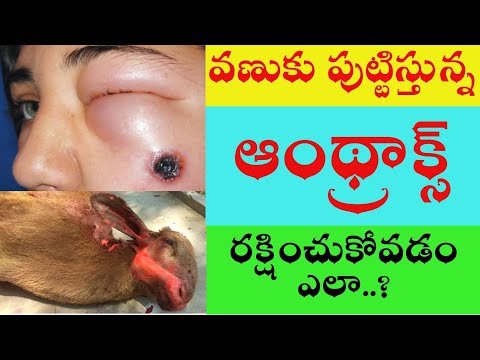 Anthrax Disease Causes, Symptoms treatment and Precautions | దొమ్మరోగం చికిత్స మరియు నియంత్రణ చర్యలు