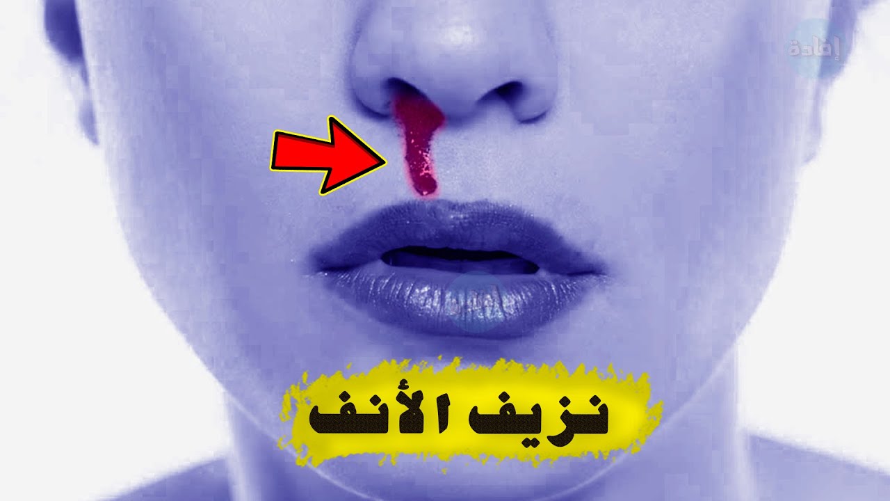 أسباب نزيف الأنف من فتحة واحدة - YouTube