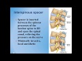 Lumbar Spinal Stenosis : Diagnosis and Treatment Options