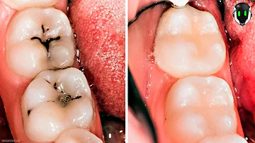 ¿Cómo puedo mejorar la salud de mis dientes?