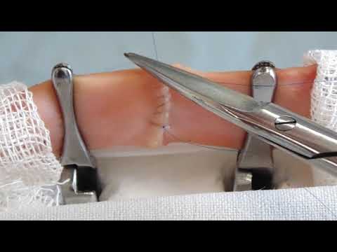 Carrel`s vascular suture technique