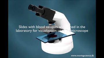 AIScope -  Malaria, from transmission to diagnosis using Artificial Intelligence