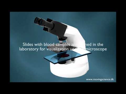 AIScope -  Malaria, from transmission to diagnosis using Artificial Intelligence