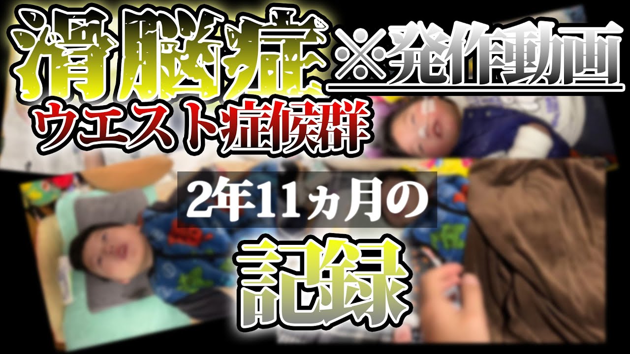 【閲覧注意】今までの発作動画の記録と対応について。