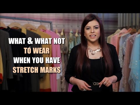how to wear short dresses with stretch marks 10 Easy Tips How to Dress to Hide Mom Belly Pooch