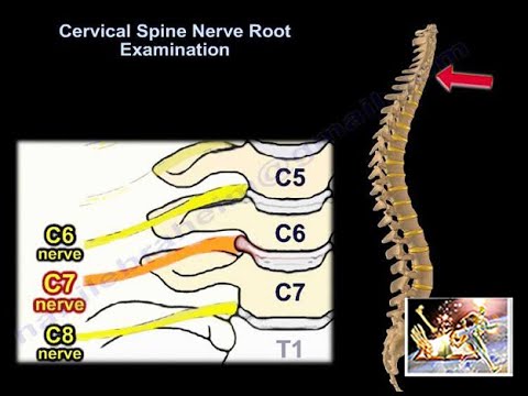 Cervical Spine Nerve Root Examination - Everything You Need To Know - Dr. Nabil Ebraheim