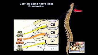 Cervical Spine Nerve Root Examination - Everything You Need To Know - Dr. Nabil Ebraheim