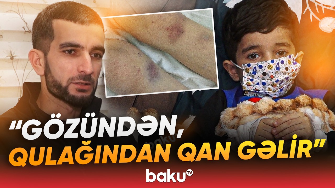 ”Aciz ata kimi xahiş edirəm” | Ağır xəstəlikdən əziyyət çəkən Pünhanın atası imdad dilədi - Baku TV