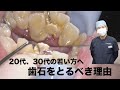 【歯石除去】40代、50代になって歯で困らないために今からしておくべきこと