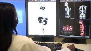 PSMA PET Scan Used For Prostate Cancer – Memorial Cancer Institute