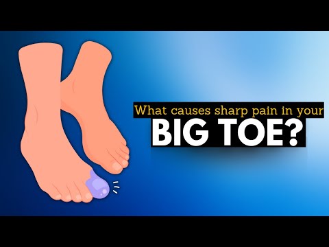 What is that pain under my big toe? (Sesamoiditis) | POGO Physio Gold Coast