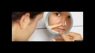 Body Dysmorphic Disorder - Psychologist Explains - Ben Buchanan