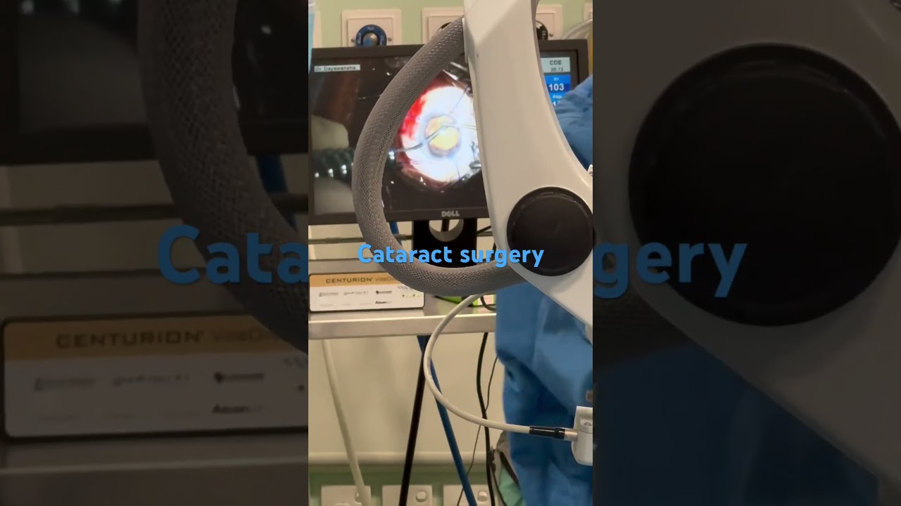 Cataract Surgery By Dr Dayawansa Eye Surgeon Eyeclinic Kandy 