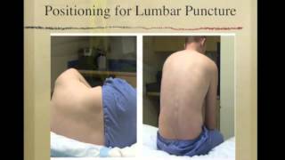 Lumbar Puncture