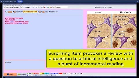 Boosting cloze review with notes from artificial intelligence (incremental reading on Alzheimer