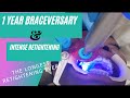 FINALLY MY OVERDUE  RETIGHTENING || BRACES RETIGHTENING|| 1 YEAR BRACEVERSARY #adultbraces