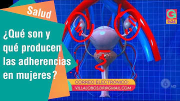 ¿De qué depende la fuerza de adherencia?