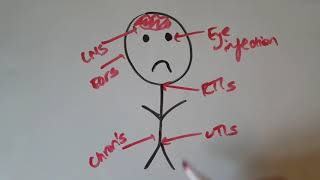 Ciprofloxacin - Drug Discovery UEA MPharm year 2