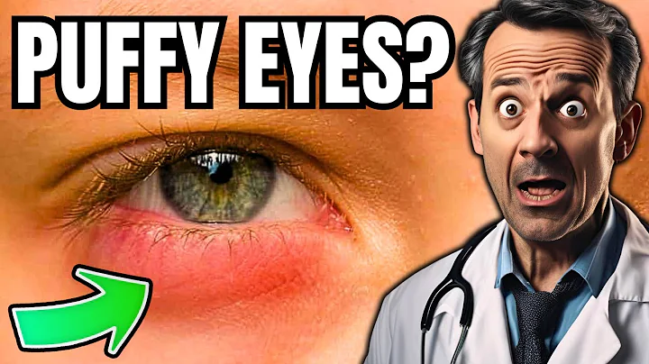 Get rid of PUFFY EYES and bags FOREVER!