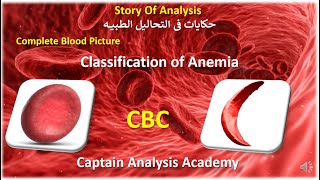 اشهر تقسيمات الانيميا E133.Classification of Anemia