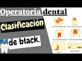 CLASIFICACIÓN DE LAS CAVIDADES DENTALES SEGUN BLACK | CARIES DENTAL EXPLICADA FACIL!