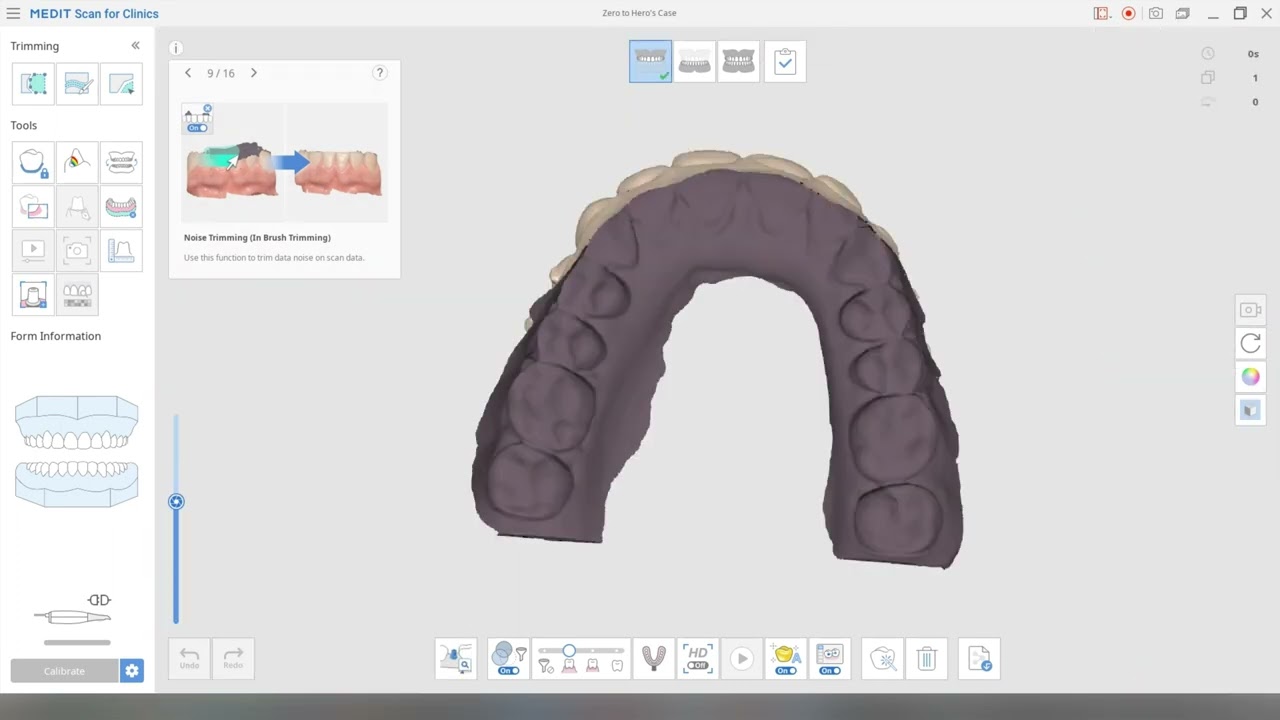 Uploading a 3rd party scan onto Medit Link - Zero to Hero course hands