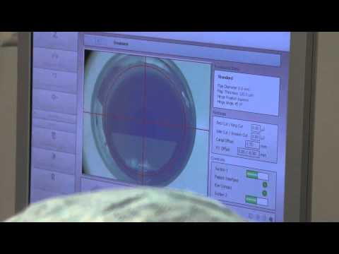 Vidéo: Par un laser femtoseconde ?