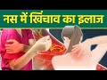 Nas me Khichav Kyu Hota Hai: नस में खिंचाव क्यों होता है,इलाज क्या है | Nerve Strain Treatment