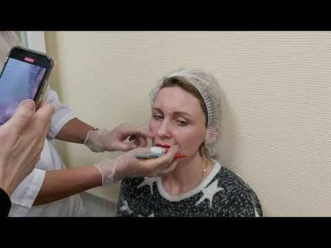 Video: Aleksandrs Prjanikovs pirmo reizi izmēģināja botoksu
