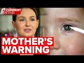 Mothers warning after toddler loses eye | A Current Affair