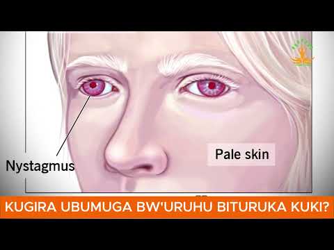 BIGENDA BITE NGO ABABYEYI BIRABURA BABYARE UMWANA UFITE UBUMUGA BW'URUHU