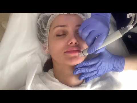 Video: Berapakah kos untuk Hydrafacial?