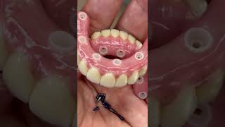 Metal Allergy Free Ceramic