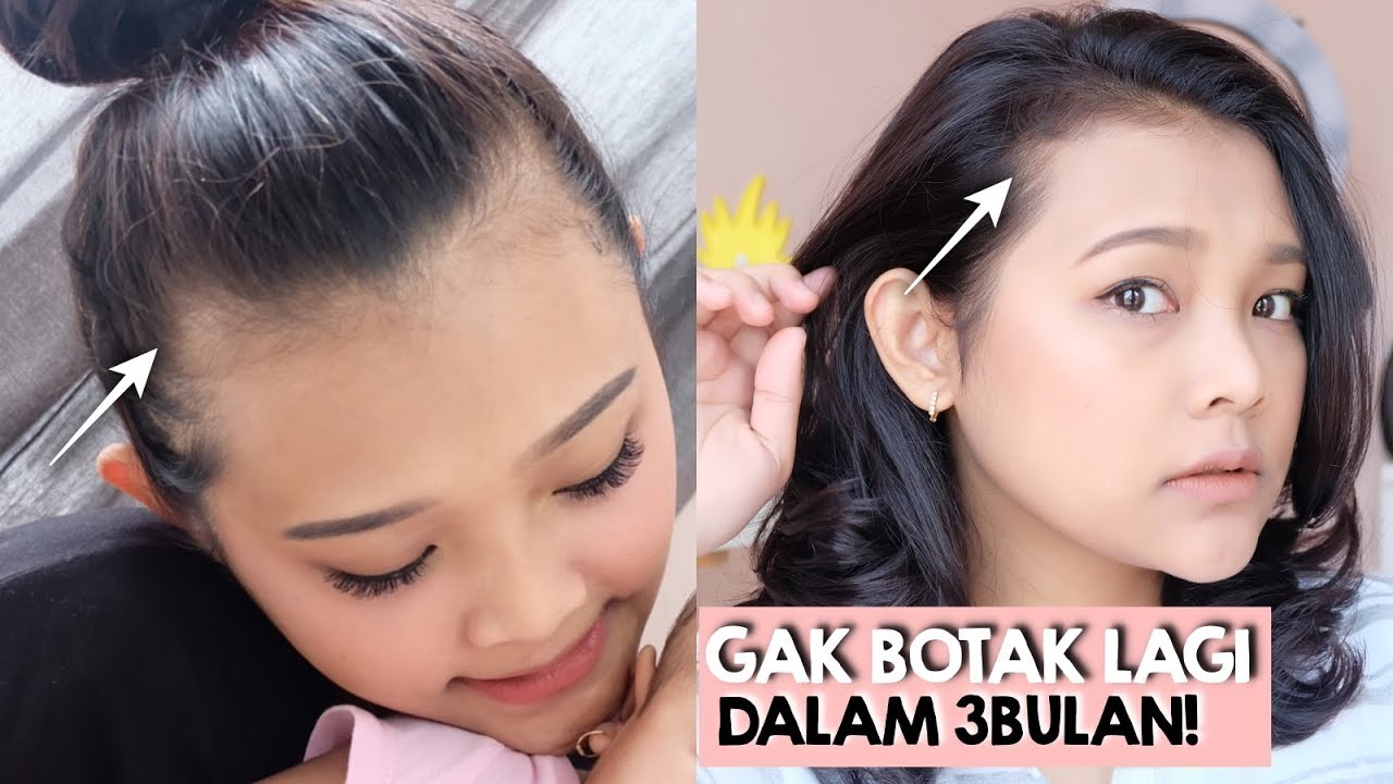 Cara Cepat Bikin Rambut Tumbuh Pakai Hair Tonic Natur Ririeprams