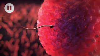 How does morning after pill works 3D animation - Anatomy with Fertilization