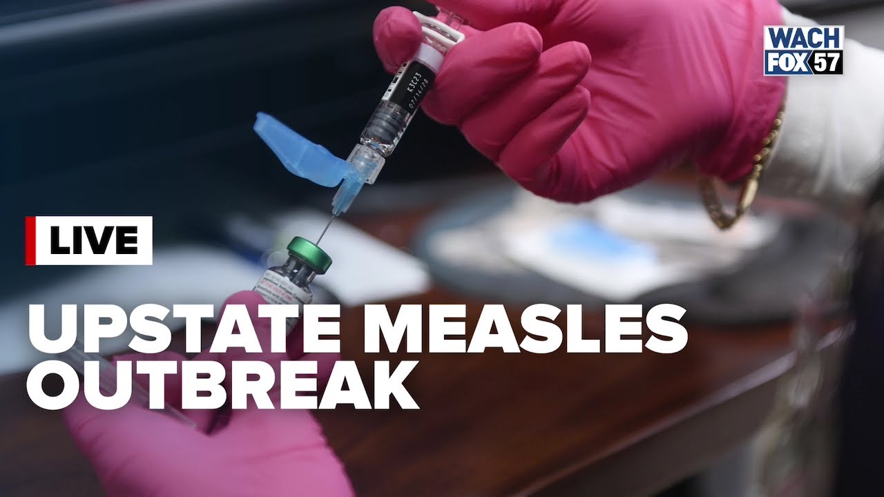 Department of Public Health addresses Upstate measles outbreak