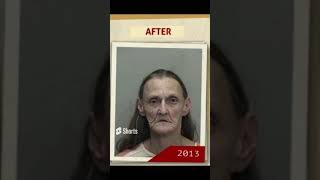 People before and after addiction #shorts