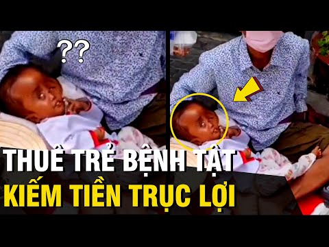 Video Thuê 'TRẺ EM' bị bệnh tật 500k/ngày để công cụ 'KIẾM... - youtube
