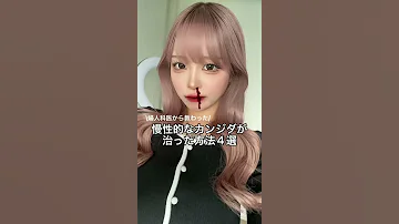 意外すぎる TikTokで200万再生された慢性的なカンジダが治好き方法4選 