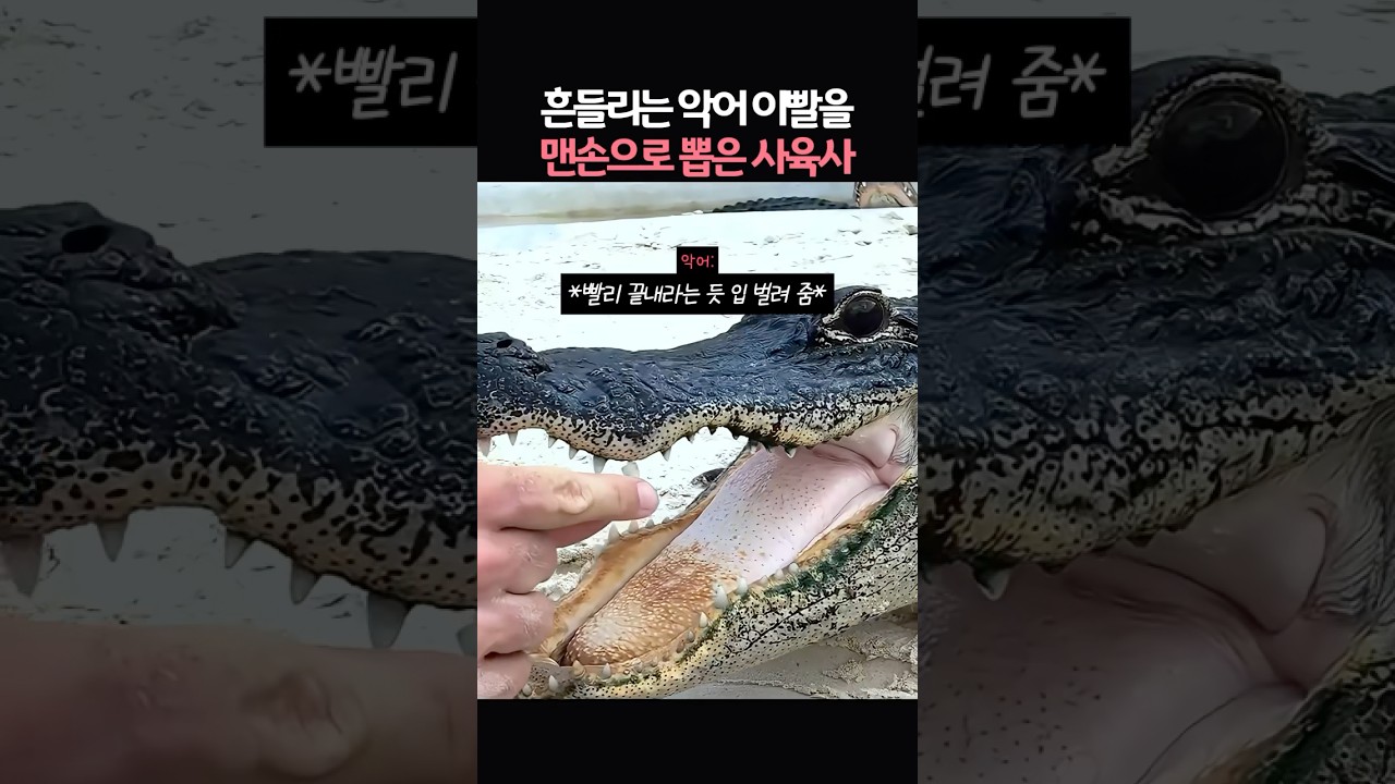 흔들리는 악어 이빨을 맨손으로 뽑은 사육사