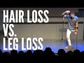 Hair loss vs leg loss  josh sundquist standup