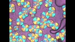 Crystallization of Polypropylene non-isothermally at 20 oC/min